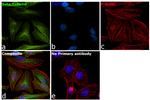 beta Tubulin Antibody in Immunocytochemistry (ICC/IF)