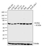 NUP62 Antibody in Western Blot (WB)