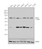 RPA70 Antibody in Western Blot (WB)