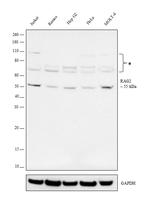 RAG2 Antibody in Western Blot (WB)