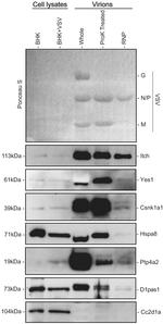 DDX3Y Antibody in Western Blot (WB)