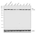 VCP Antibody in Western Blot (WB)