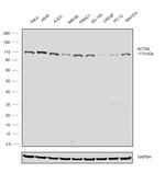 alpha Actinin 4 Antibody in Western Blot (WB)