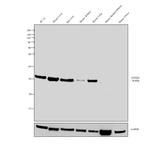 GSTM1 Antibody