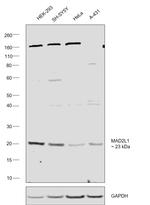 MAD2 Antibody in Western Blot (WB)