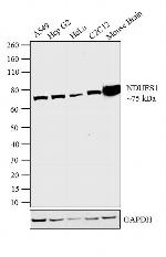 NDUFS1 Antibody in Western Blot (WB)