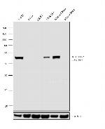 ALDH1A2 Antibody in Western Blot (WB)