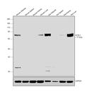 ACSL1 Antibody