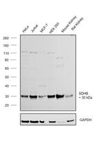 SDHB Antibody in Western Blot (WB)