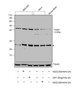 TXNIP Antibody in Western Blot (WB)