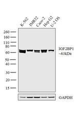 IGF2BP1 Antibody in Western Blot (WB)