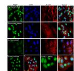 SUMO1 Antibody in Immunocytochemistry (ICC/IF)