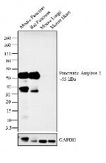 Pancreatic Amylase Antibody in Western Blot (WB)