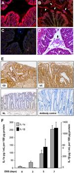 IL-1 alpha Antibody in Immunohistochemistry (IHC)