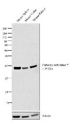 Carbonic Anhydrase II Antibody in Western Blot (WB)