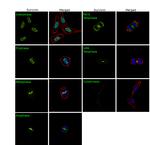 Survivin Antibody