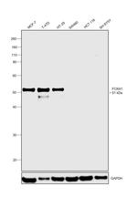 FOXA1 Antibody in Western Blot (WB)