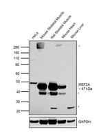 MEF2A Antibody in Western Blot (WB)