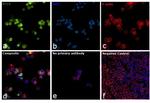 BCL6 Antibody in Immunocytochemistry (ICC/IF)