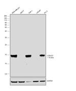 Galectin 1 Antibody in Western Blot (WB)