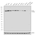 alpha Actinin 4 Antibody