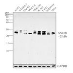 SNRPB Antibody in Western Blot (WB)