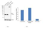 Profilin 1 Antibody