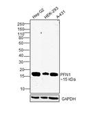 Profilin 1 Antibody in Western Blot (WB)