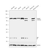 TRIM28 Antibody in Western Blot (WB)