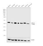 LYPLA2 Antibody in Western Blot (WB)