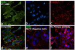 DDR2 Antibody in Immunocytochemistry (ICC/IF)