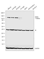 DDR2 Antibody in Western Blot (WB)