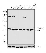 ATP Synthase B1 Antibody in Western Blot (WB)