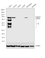 SAMHD1 Antibody in Western Blot (WB)