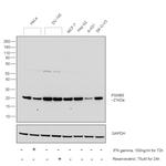 PSMB5 Antibody in Western Blot (WB)