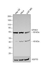 SPHK1 Antibody in Western Blot (WB)