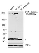 alpha Dystroglycan Antibody in Western Blot (WB)