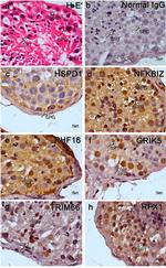 PHF16 Antibody in Immunohistochemistry (IHC)