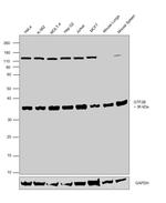 GTF2B Antibody in Western Blot (WB)