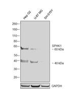 SPHK1 Antibody in Western Blot (WB)