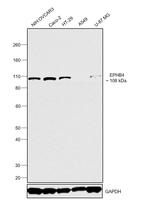 EphB4 Antibody in Western Blot (WB)