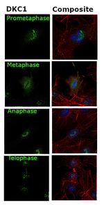 DKC1 Antibody