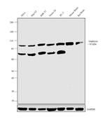 Gephyrin Antibody in Western Blot (WB)