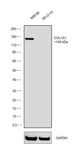 COL6A1 Antibody in Western Blot (WB)