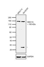 SMC1 Antibody in Western Blot (WB)