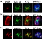 SMC3 Antibody in Immunocytochemistry (ICC/IF)