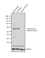 Calcineurin A Antibody in Western Blot (WB)