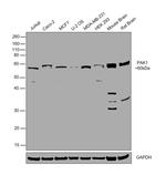 PAK1 Antibody in Western Blot (WB)