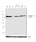 ATP Citrate Lyase Antibody in Western Blot (WB)