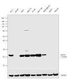 GSTP1 Antibody in Western Blot (WB)